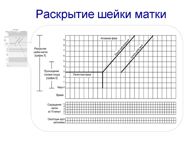 Раскрытие шейки матки